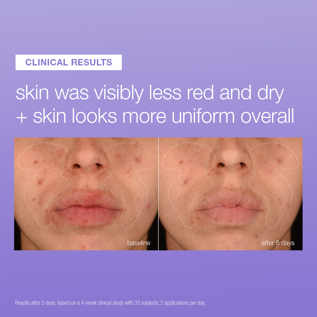 Dermalogica Stabilizing Repair Serum - Image 4