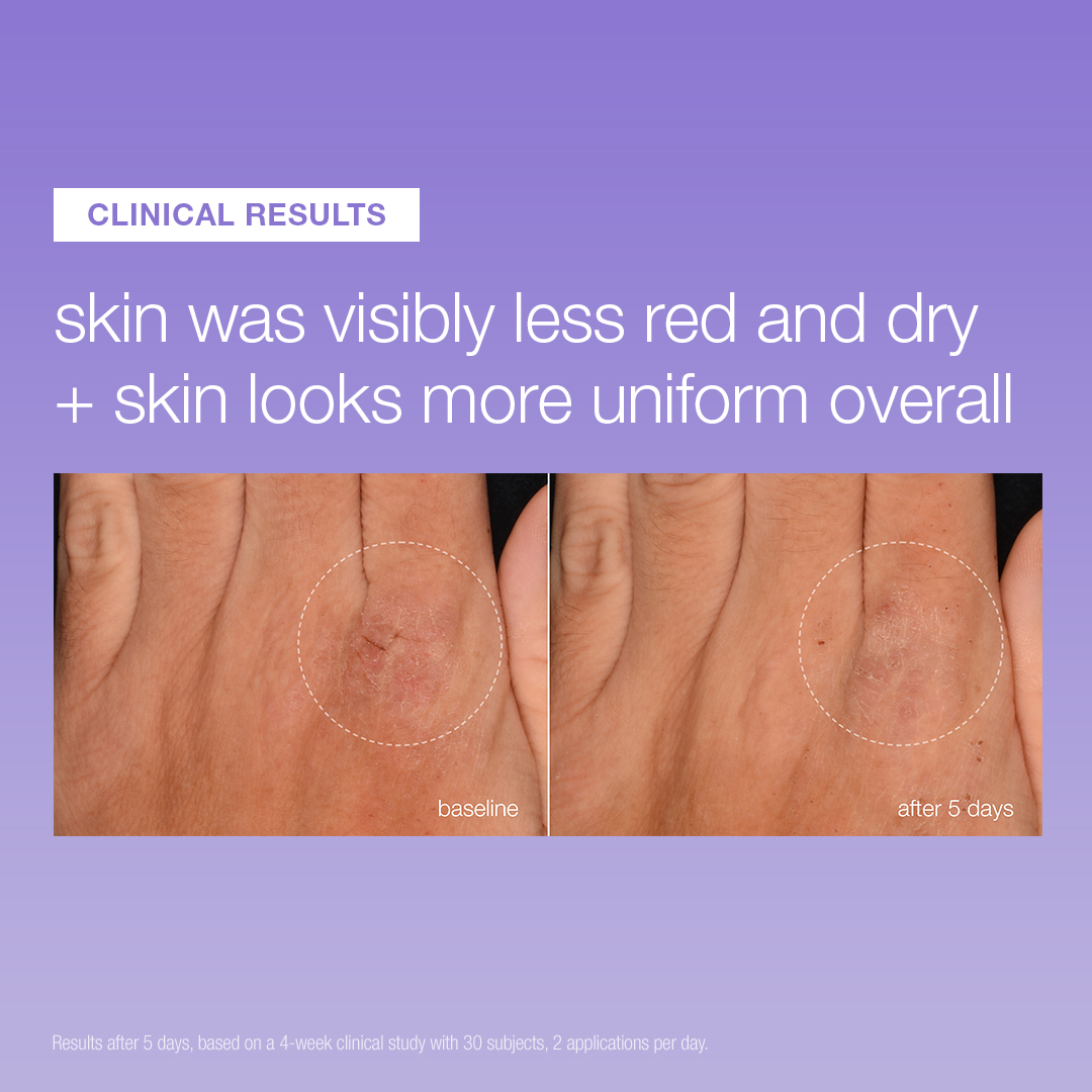 Dermalogica Stabilizing Repair Serum - Image 3